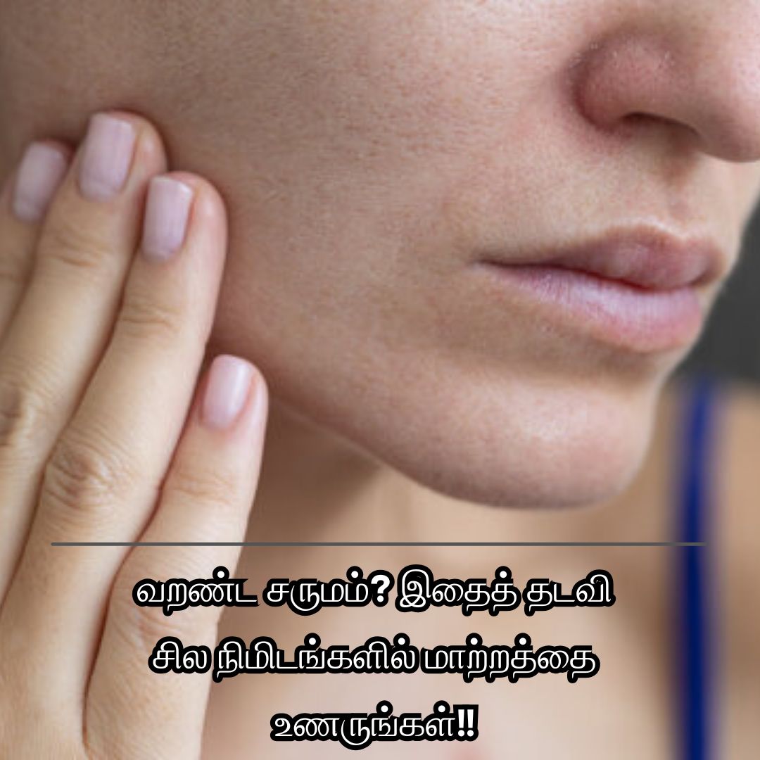 வறண்ட சருமம்? இதைத் தடவி சில நிமிடங்களில் மாற்றத்தை உணருங்கள்!!