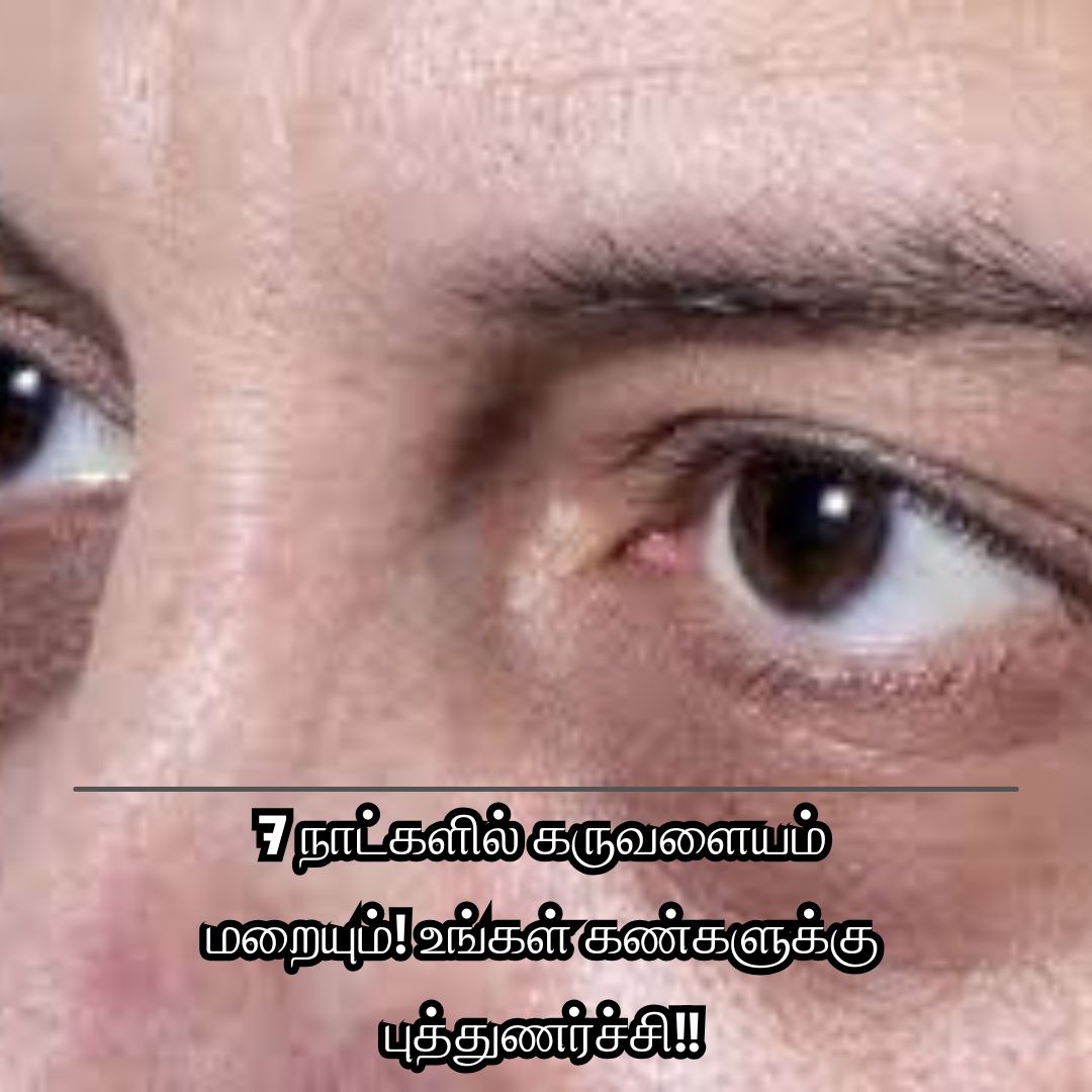 7 நாட்களில் கருவளையம் மறையும்! உங்கள் கண்களுக்கு புத்துணர்ச்சி!!
