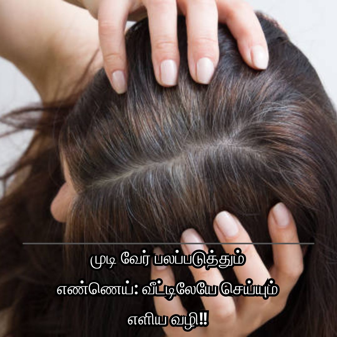 முடி வேர் பலப்படுத்தும் எண்ணெய்: வீட்டிலேயே செய்யும் எளிய வழி!!