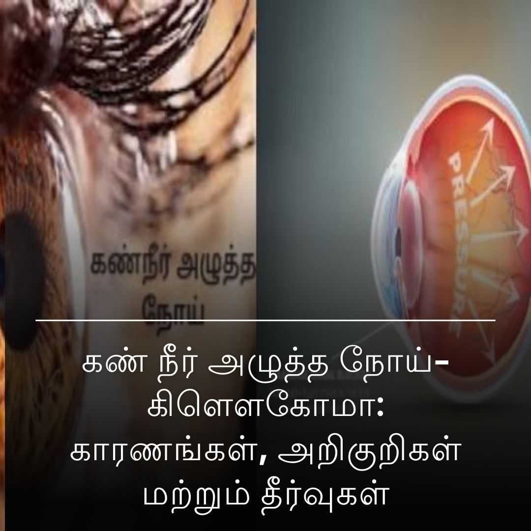 கண் நீர் அழுத்த நோய்-கிளௌகோமா: காரணங்கள், அறிகுறிகள் மற்றும் தீர்வுகள்