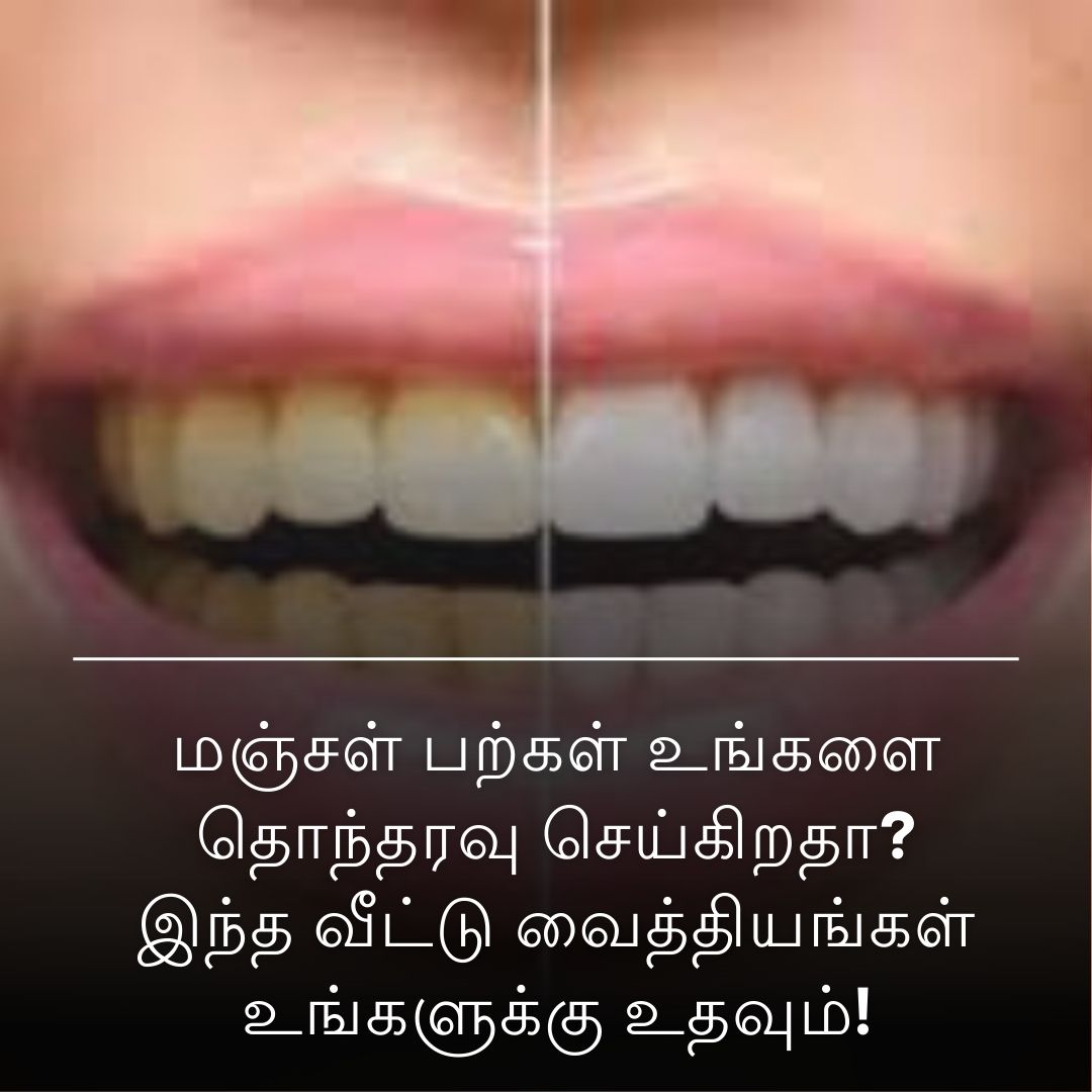 மஞ்சள் பற்கள் உங்களை தொந்தரவு செய்கிறதா? இந்த வீட்டு வைத்தியங்கள் உங்களுக்கு உதவும்!