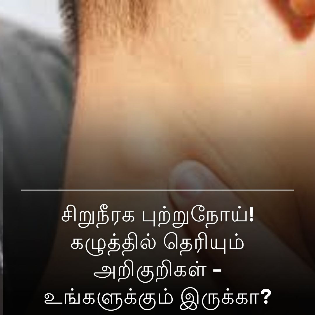 சிறுநீரக புற்றுநோய்! கழுத்தில் தெரியும் அறிகுறிகள் - உங்களுக்கும் இருக்கா?