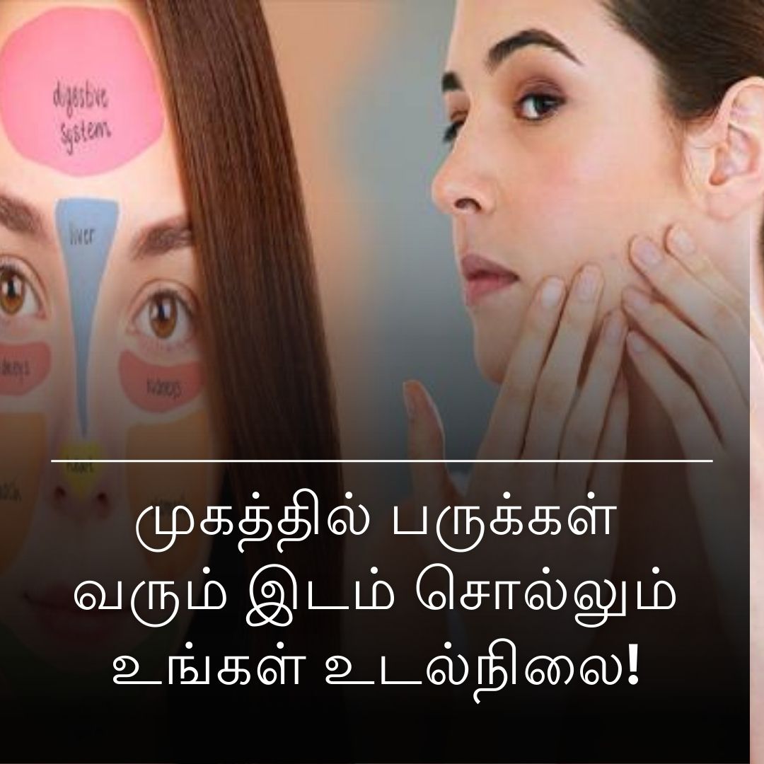 முகத்தில் பருக்கள் வரும் இடம் சொல்லும் உங்கள் உடல்நிலை!